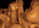 Aborto: El Grito Silencioso